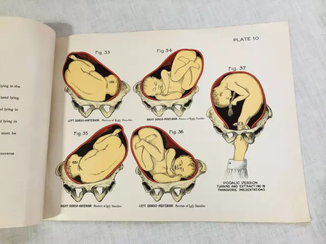 1912 Obstetrical Charts In Colors Battle & Company Chemists Corp St. Louis Mo