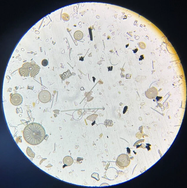 J.D. Moller Microscope Slide Diatom Arachnoidiscus Japan Gold Medal 1869