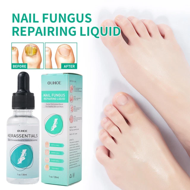 Kerassentials For Toenail Fungus Kerassentials Toenail 30ml Treatment G4W0