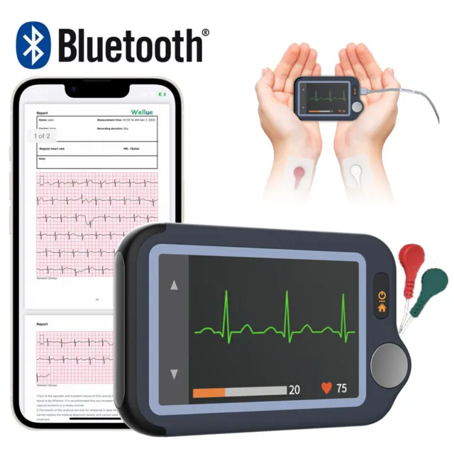 Mobile tragbare EKG Geräte 30s/60s/5min Aufzeichnung Bluetooth Smartphone und PC