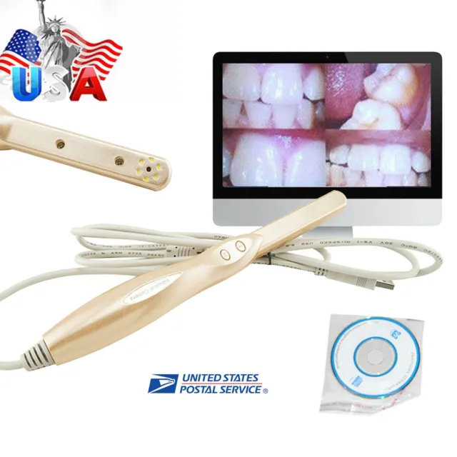 Dental Intraoral Oral Camera USB 2.0 Dynamic 4 Mega Pixels 6-LED + Software Free