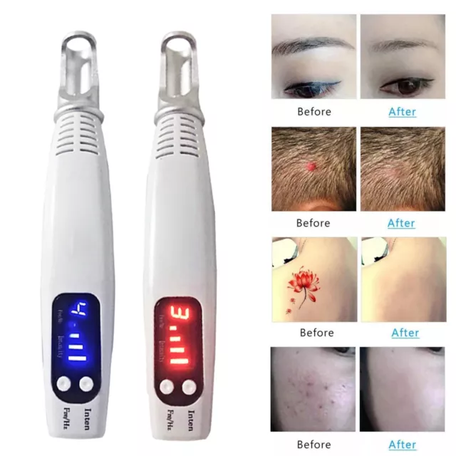 Red/Blue Light Picosecond Laser Pen Tattoo Mole Dark Spot Removal Handheld