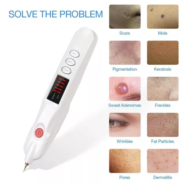 Plasma Pen Freckle Wrinkle Mole Removal Lonic Skin Scares Black Spot Removal