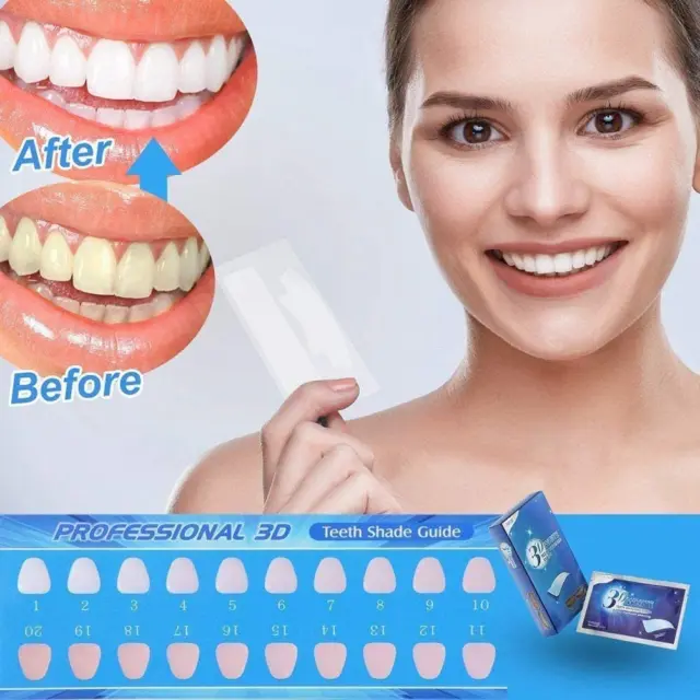 Strisce Sbiancanti Denti (14 Strisce), Professional Teeth Whitening Strips,Sbian 3