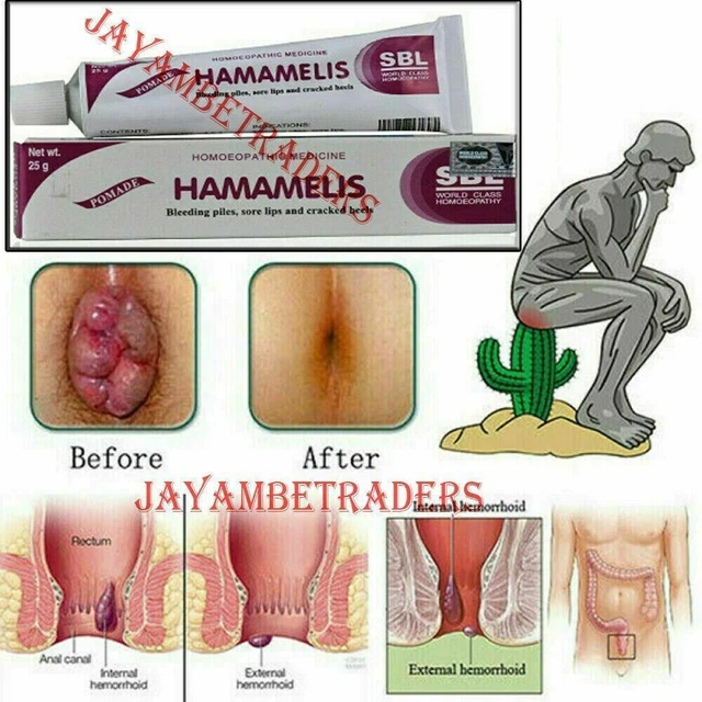 2 x 25GM Hämorrhoiden entfernen Kräutercreme Linderung Stapel Schmerzen reduzieren Juckreiz Verbrennungen