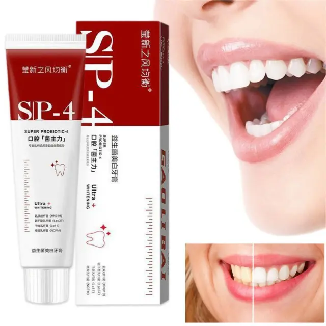 SP-4 Probiotische Zahnpasta, Sp-4 Zähne Zahnpasta Aufhellung HOT A3U2
