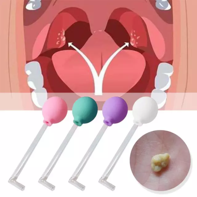 Mandelstein Entfernen Werkzeug Reiniger Removal Set *