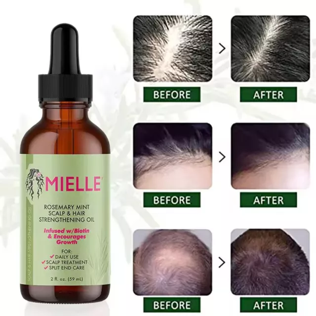 1-5X Mielle Rosemary Mint Scalp & Hair Strengthening Oil 57g (2oz) 59ml
