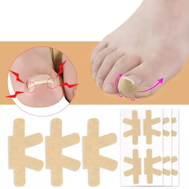 Pediküre Fuß korrektor Elastizität Zehen nagel pflege