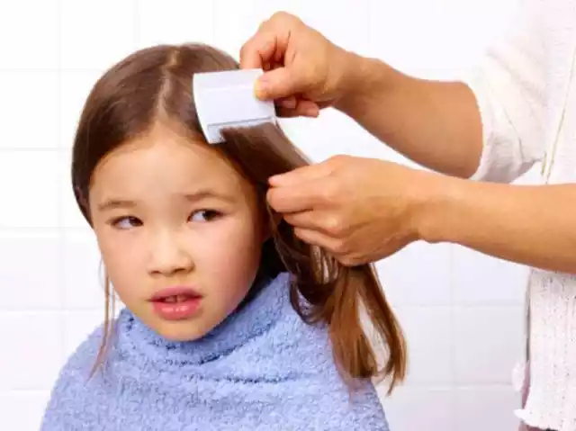 2X White Double Sided Nit Combs for Head Lice Detection 2