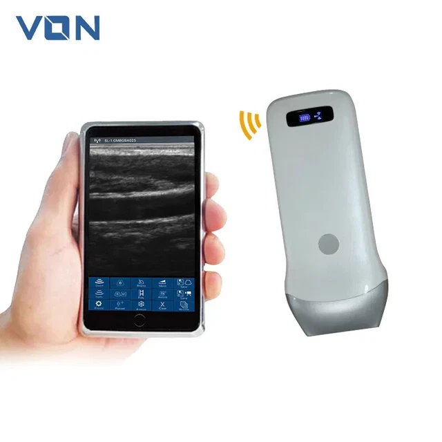 VON 128 Elements Micro Convex Probe Portable Handheld Wireless Ultrasound