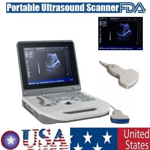 12" Portable Laptop Full Digital Ultrasound Scanner Machine w/ Convex Probe A++