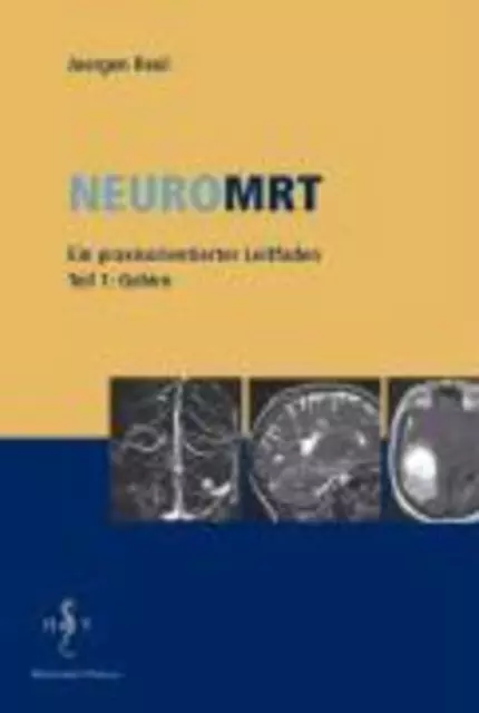 NeuroMRT 1 | Gehirn. Ein praxisorientierter Leitfaden | Juergen Reul | Deutsch