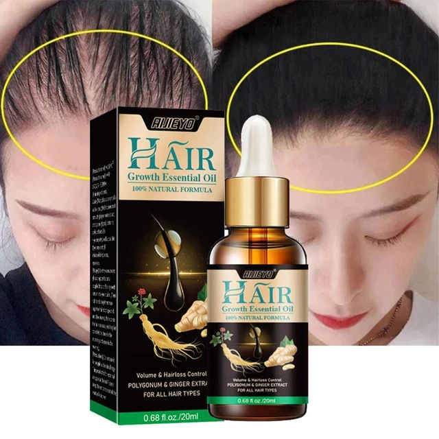 HAIR GROWTH SERUM For Black Women Anti Hair Loss Thinning GXau t,2 F6Z9