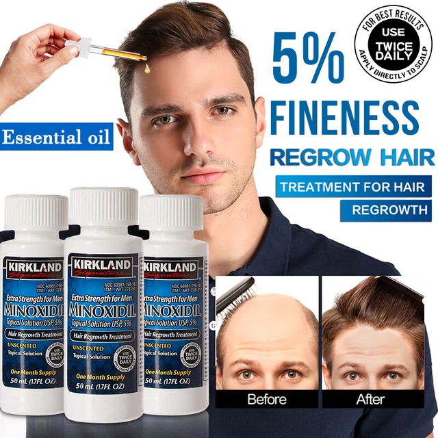 KIRKLAND MINOXIDIL 5 Hair Regrowth Solution Extra Strength Men 6 Month