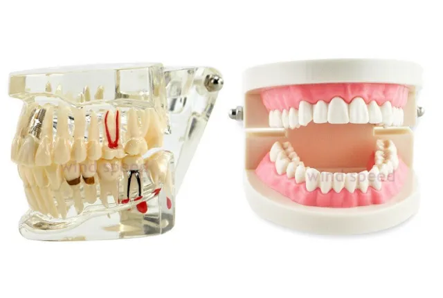 Dental Teeth Model Teach Study Teaching Implant Adult Analysis Demonstration