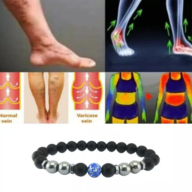 5Pcs Anti-Swelling Black Obsidian Anklet Magnet Weight Loss Bracelet Women Men 3