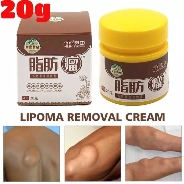 Crema de eliminación de lipomas, crema de eliminación de lipomas Huangfutang, crema de tratamiento de lipomas*