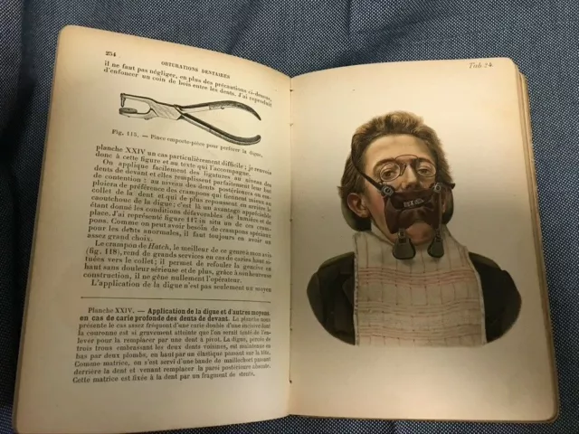 *** Atlas-manuel des Maladies des Dents   Chompret-Preiswerk  1905 ***