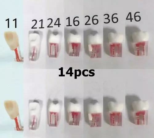 14pcs Dental Clear Root Canal Teeth Study Practice Model Endodontic Pulp Files