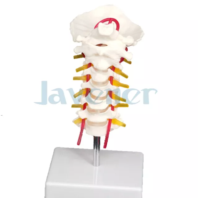 OCCIPITAL SPINAL ARTERIA Spine Nerves Cervical Vertebrae Orthopedic ...