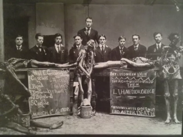 Antique Medical College Cadavers Photo 109b Oddleys Strange & Bizarre 2