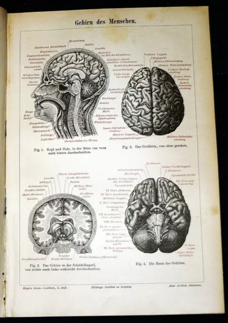 GEHIRN des MENSCHEN Neurologie Anatomie Lithographie von 1894 – 127 Jahre ORIGIN