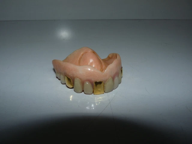 Ancien Dentier / Lot De 2 Prothèses Dentaires Vintage - Objet De Collection Ou Curiosité