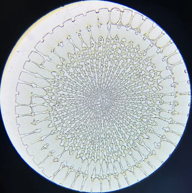 J.D. Moller Microscope Slide Sea Urchin Parasalenia Gratiosa Ag. Tonga