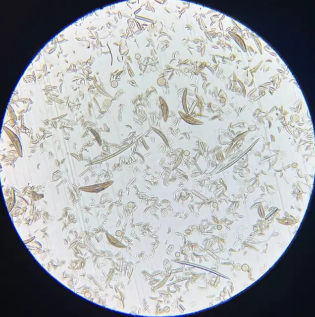 J.D. Moller Microscope Slide Diatom Fossil San Andres Mexico 1869 Gold Medal