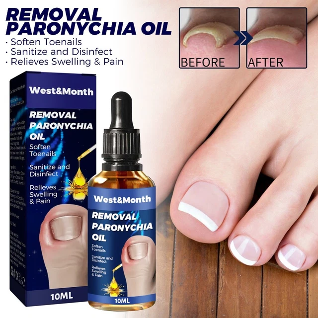 Paronychia Relief Oil Nail Serum Ingrown Toenails Care Oil Nail Recover Oils