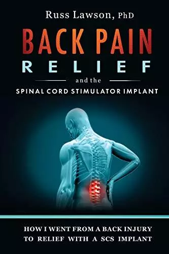 Back Pain Relief and the Spinal Cord Stimulator Implant: How I w