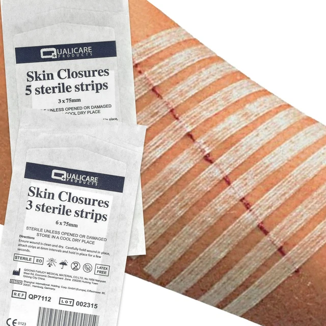 STERILE SKIN CLOSURE STRIPS Butterfly/Steri Cut Support Stitches 3mm