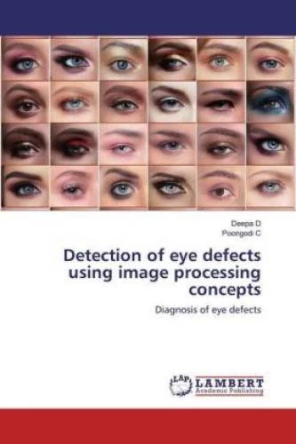 DETECTION OF EYE defects using image processing concepts Diagnosis of ...