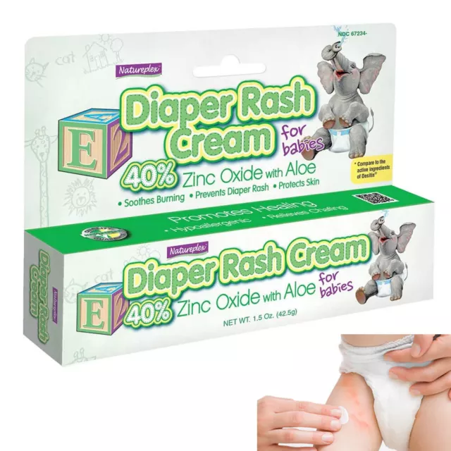Baby Diaper Rash Cream 40% Zinc Oxide Soothes Relief Chafing Aloe