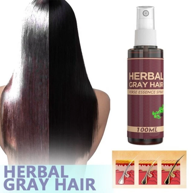 Cuidado del cabello loción para el crecimiento del cabello calvicie reparación spray pérdida de cabello aceite