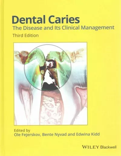 Dental Caries : The Disease and Its Clinical Management, Hardcover by Fejersk...