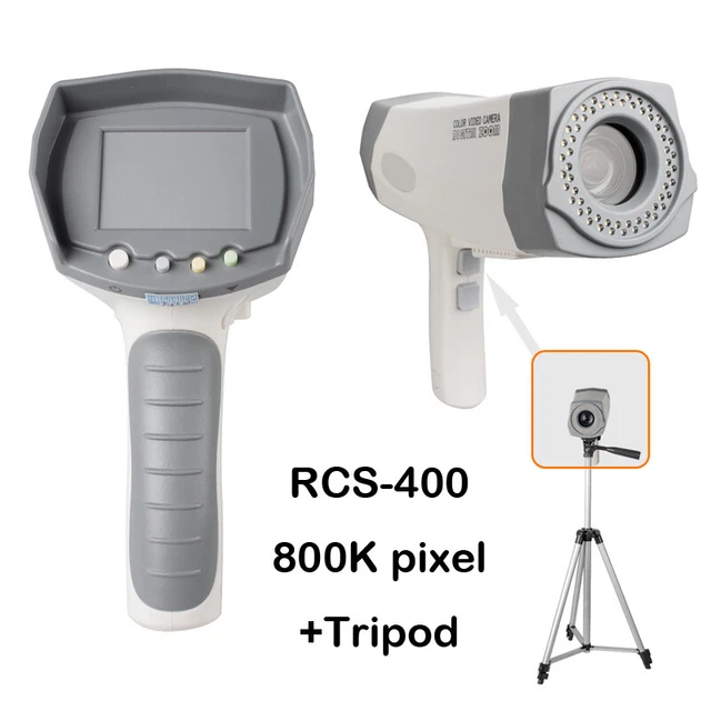 Carejoy Digital Electronic Colposcope Vaginal Image RCS-400 800,000 Pixel&Tripod