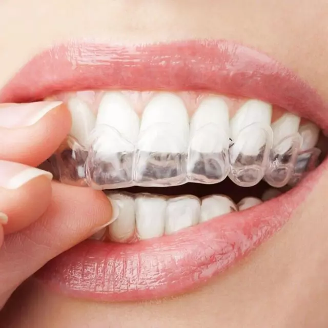 Adult Dental Orthodontic Teeth Corrector Braces Tooth Retainer Straighten Tool