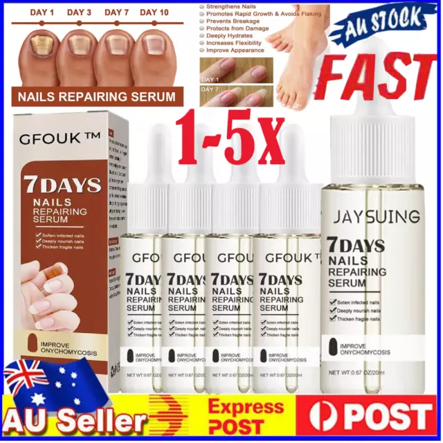 1-5X 7 Days Nail Growth And Strengthening Serum, Nail Growth And Strength Serum