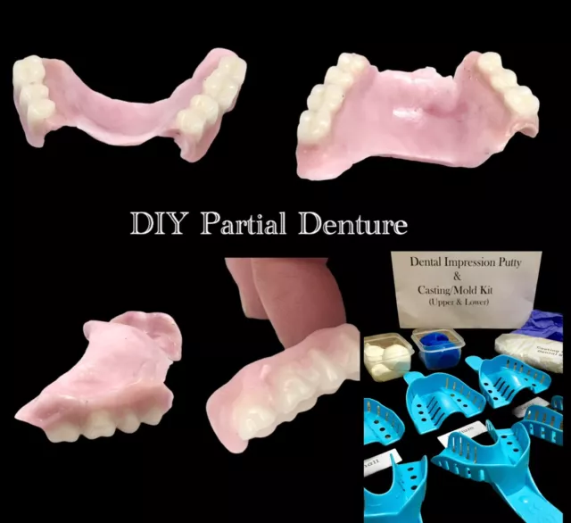 DIY Partial Denture Kit Putty Dental Impression At Home Denture Making A1/23